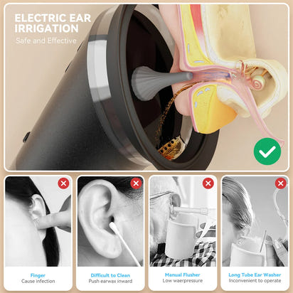 GentleEars™ Ear Flush Pro