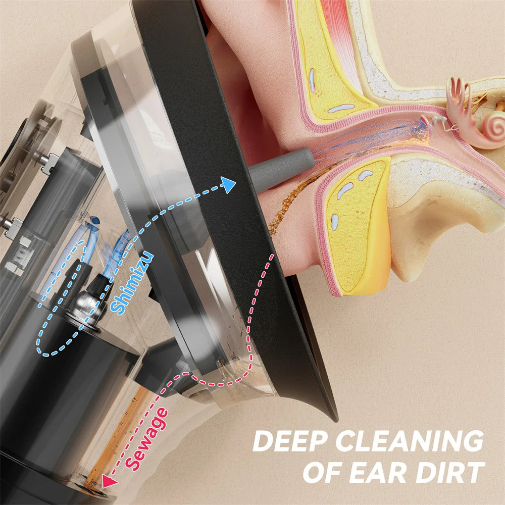 GentleEars™ Ear Flush Pro